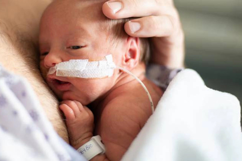 Pampers und wellcome unterstützen Eltern Frühgeborener